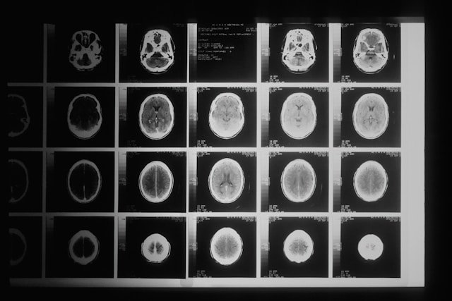 How Cancer Is Diagnosed